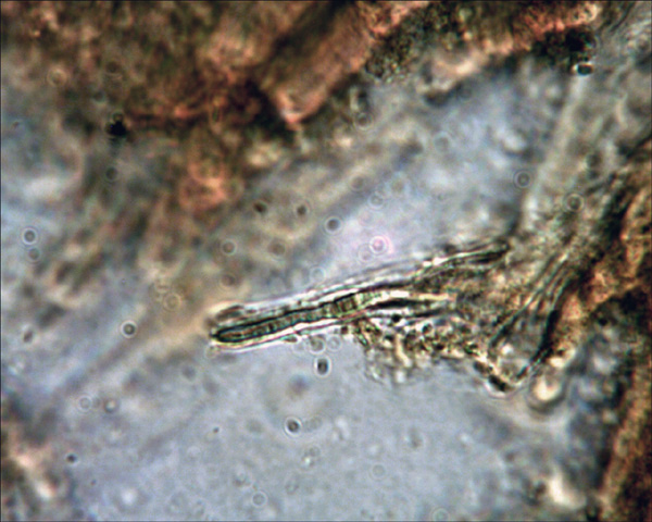 Xerocomus da determinare